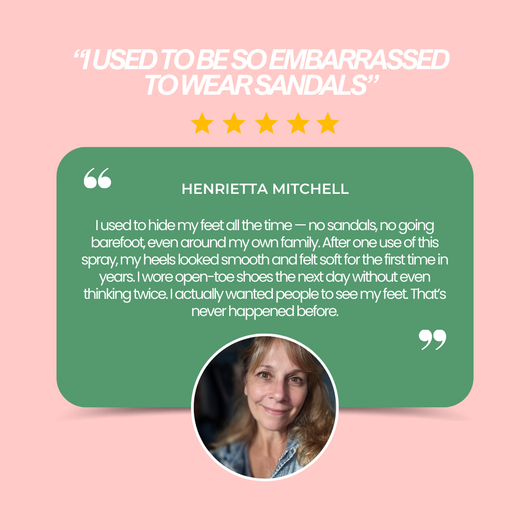 Peele™ Instant Foot Peeling Spray