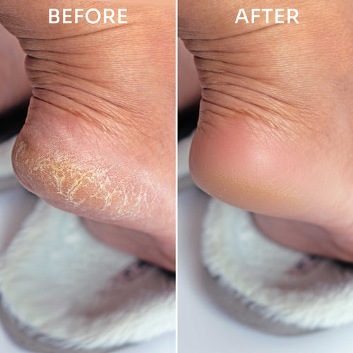 Exfoliating Glass Foot FIle