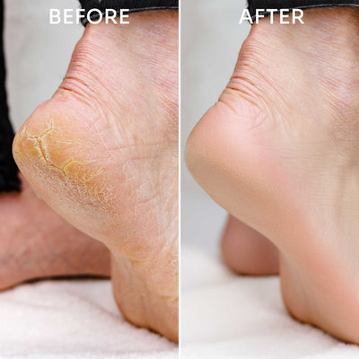 Exfoliating Glass Foot FIle