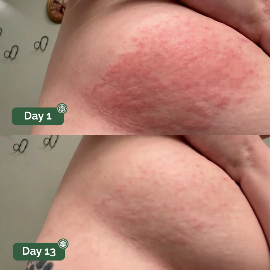 Peele™ Antifungal Soap