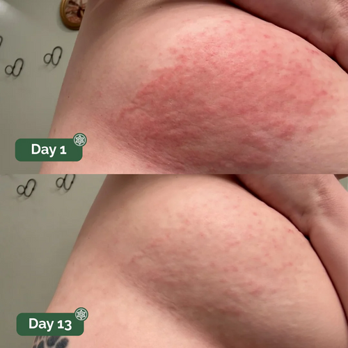 Peele™ Antifungal Soap