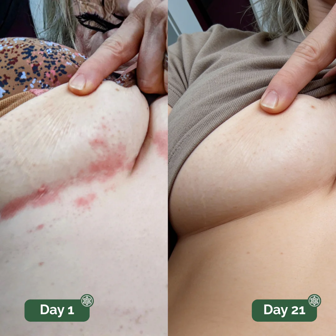 Peele™ Antifungal Soap