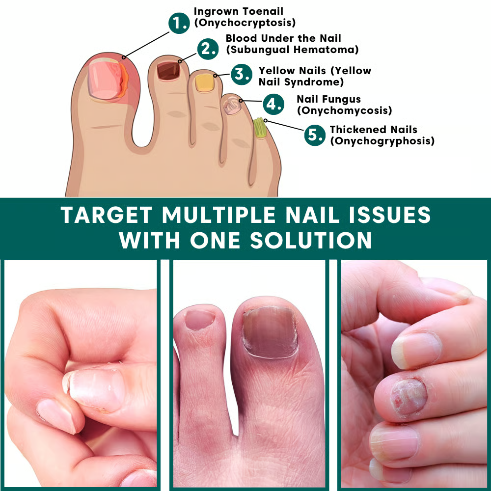 Nail Care Pen