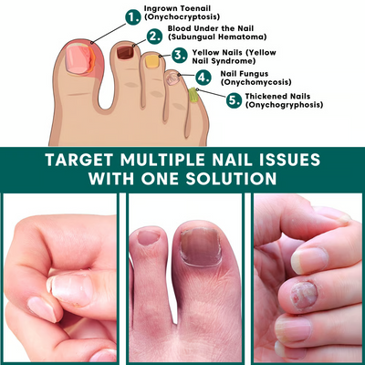 Nail Care Pen